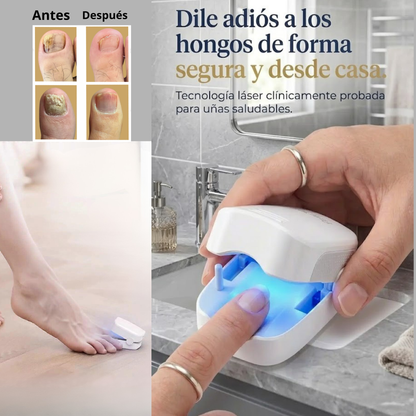 Dispositivo Láser para Hongos en las Uñas