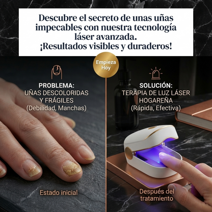 Dispositivo Láser para Hongos en las Uñas