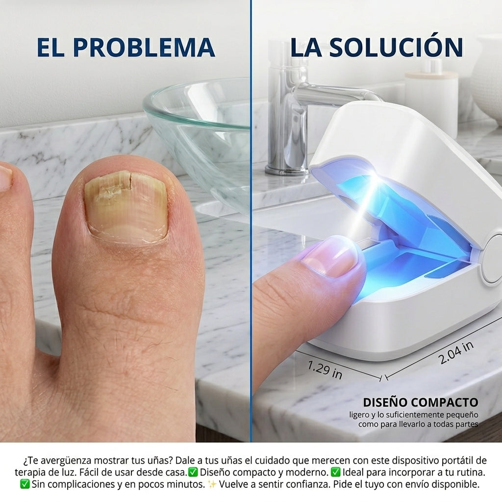 Dispositivo Láser para Hongos en las Uñas