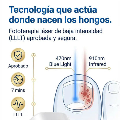 Dispositivo Láser para Hongos en las Uñas